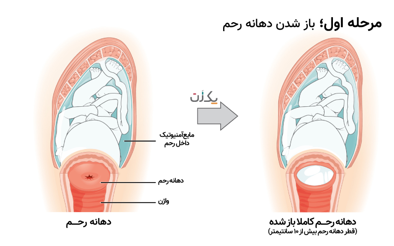 مراحل زایمان طبیعی با عکس